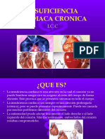 Insuficiencia Cardiaca Cronica