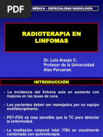 Radioterapia en Linfomas