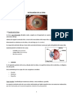 Uveitis