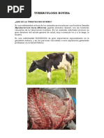 Tuberculosis Bovina