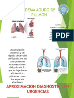 Edema Agudo de Pulmon