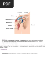 Bursitis