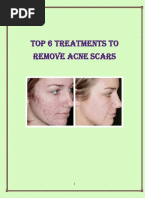 Sean Lowry's-The Fast Home Scar Removal