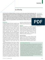 Developmental Dysplasia of The Hip