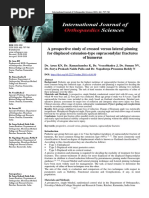 A Prospective Study of Crossed Versus Lateral Pinning For Displaced Extension-Type Supracondylar Fractures of Humerus