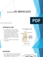 Lesiones Meniscales QX