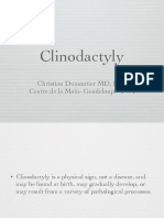 Clinodactyly: Christian Dumontier MD, PHD Centre de La Main-Guadeloupe - Fwi