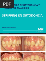 Stripping en Ortodoncia