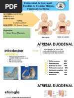 Atresia Duodenal