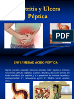 13 - Gastritis y Ulcera