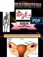 Congenital Anomelies of Reproductive Organs