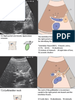 02.gall Bladder