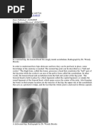 Hip Dislocation in Dogs and Cats (Wendy Brooks, DVM)