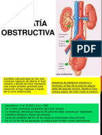 Uropatia Obstructiva