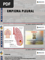 Empiema Pleural