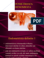 Endometrioza Si Adenomioza