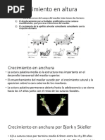 Crecimientos Del Maxilar