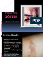 Herpes Zoster