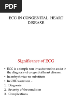 Ecg in Congenital Heart Disease