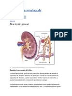 Insuficiencia Renal Agud1