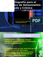 Osteomielitis Aguda y Cronica