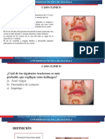 Caso Clinico Impetigo