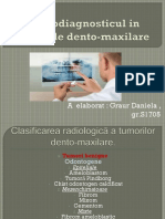 Radiodiagnosticul in Tumorile Dento Maxilare