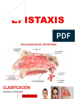 EPISTAXIS