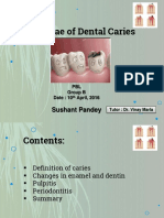 Sequelae of Dental Caries