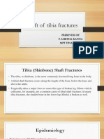 Shaft of Tibia Fractures