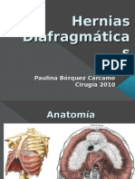 Hernias Diafragmáticas