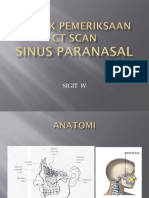 Teknik Pemeriksaan CT Scan Sinus Paranasal