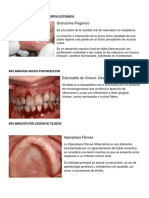 Inf. Agudas