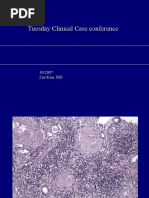 Acute Interstitial Nephritis