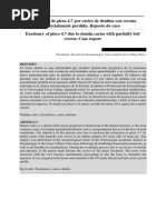 Artículo Caso Clínico Exodoncia