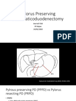 Pylorus Preserving Pancreaticoduodenectomy