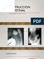 Obstruccion Intestinal R2