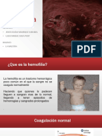 Hemofilia en Pediatria