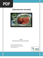 Hipocalcemia Neontal