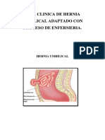 Guia de Hernia Umbilical