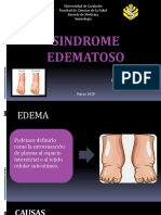 Sindrome Edematoso