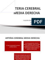 Arteria Cerebral Media Derecha