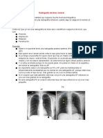 Radiografia Normal de Torax