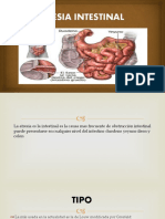 Artesia Intestinal