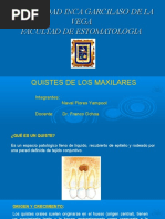 Quiste de Los Maxilares PDF