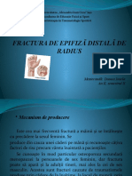 Fractura de Radius