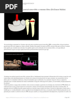 Decálogo de La Prótesis Parcial Removible A Extremo Libre (DR - Ernest Mallat)