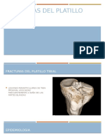 Fracturas Del Platillo Tibial