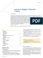 Fractures de La Diaphyse Femorale Chez L Enfant PDF