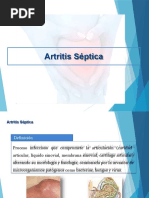 ARTRITIS